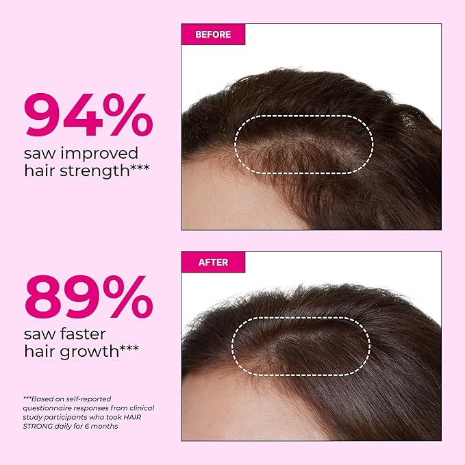 HUM Hair Strong Daily Hair Growth Supplement with Biotin, Zinc, Vitamin B12 to Support Growth, Folic Acid & Vitamin B12 Vitamins for Healthy Hair Support for Women and Men, 180 Vegan Capsules