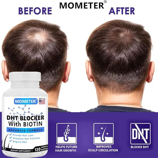 DHT Blocker Supplement for Hair Growth - Saw Palmetto, Biotin & Zinc for Women & Men - Stimulate Follicles, Reduce Hair Loss, Regrow Thicker Hair(120 Capsules)