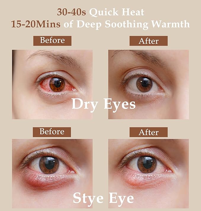 Heated Eye Mask (2-Packs), Moist Warm Compress Microwave with Flaxseed Cassia Seed, Weighted Eye Mask for Sleeping, Dry Eyes, Stye Eye Treatment, Relief Eye Fatigue (Black&Grey)