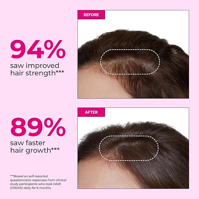 HUM Hair Strong Daily Hair Growth Gummies with Biotin, Zinc, Vitamin B12 to Support Growth, Folic Acid & Vitamin B12 Gummy Vitamins for Healthy Hair Support for Women and Men, 60 Gummies